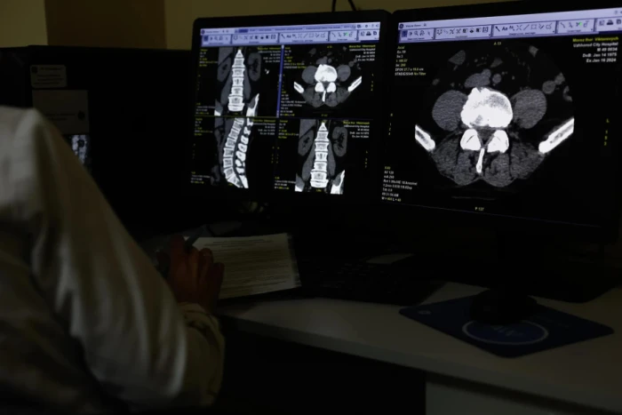 Ужгородська міська клінічна лікарня отримала новий комп’ютерний томограф